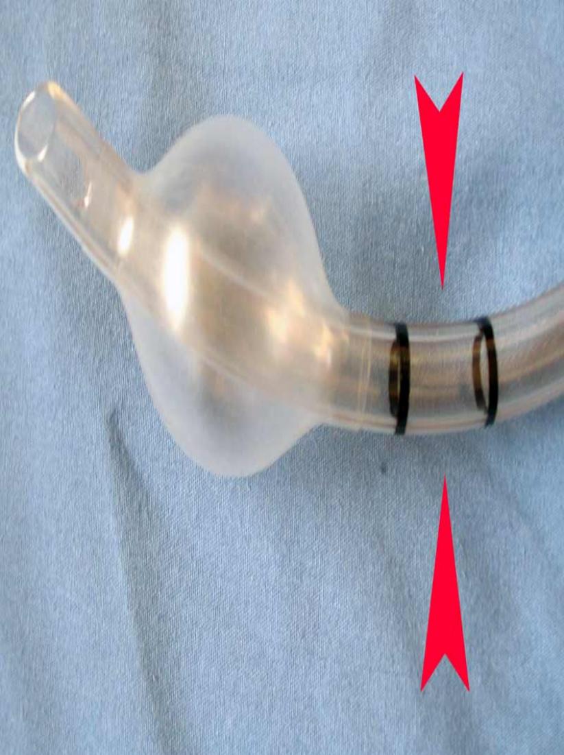 intubation guide