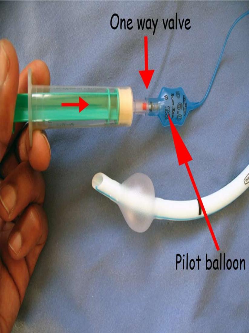 pilot balloon