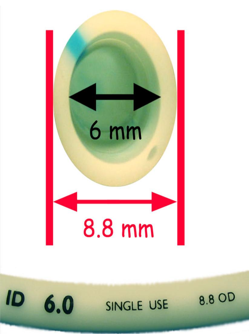 internal diameter