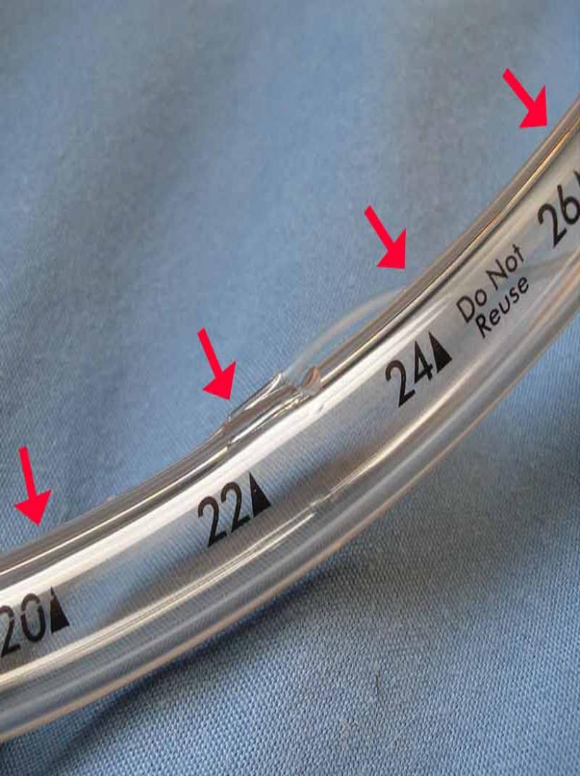 tracheal tube length markings